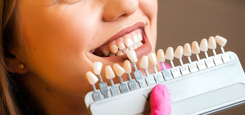 Dental Bonding in Gold Coast