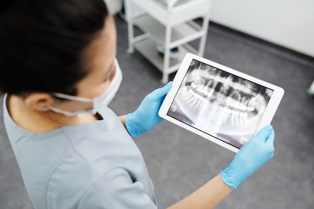 Guide to Root Canal Treatment - Importance of follow up