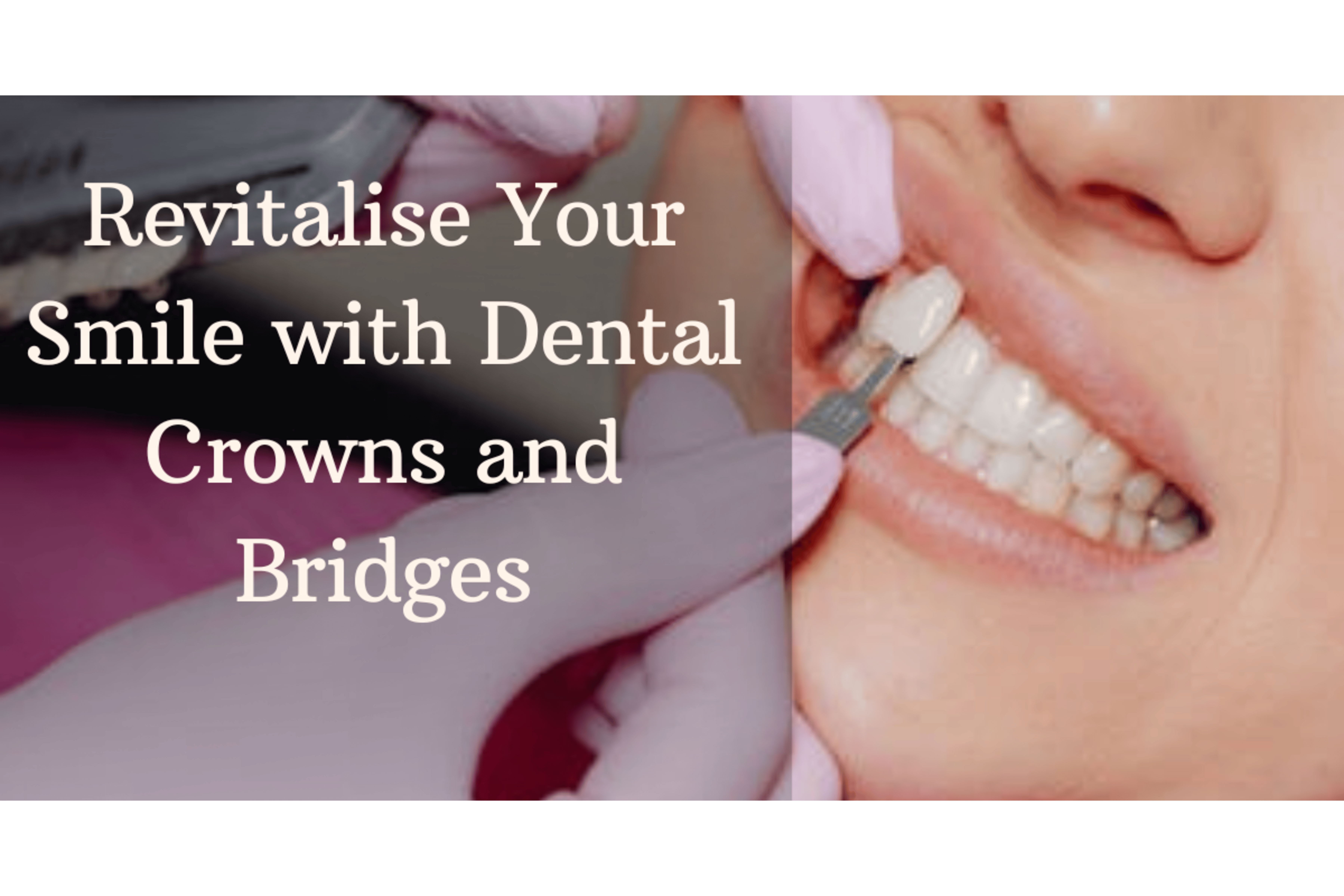 checking dental crown and bridge