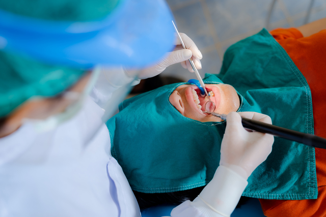 Dentist extracting a tooth from a patient during wisdom teeth removal