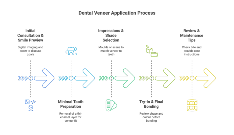 Dental Veeners Application Process