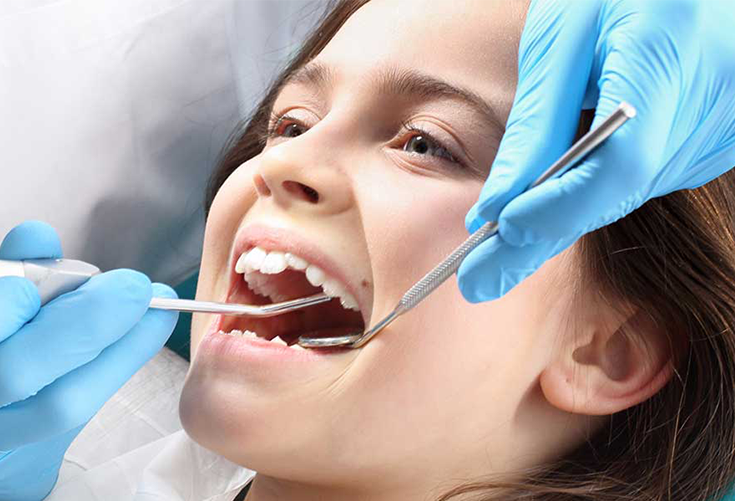 Root-Canal-Treatment