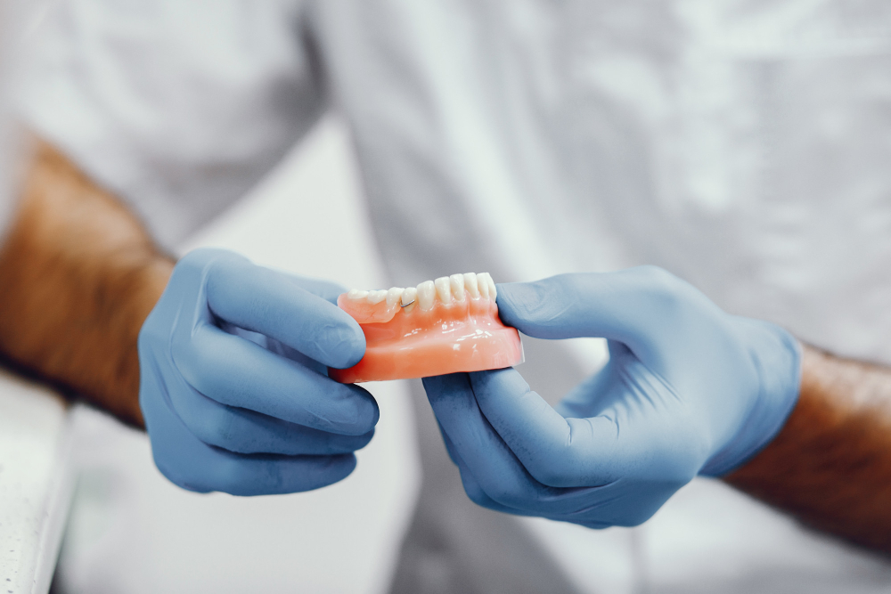 Overdentures and implant supported dentures in Gold Coast