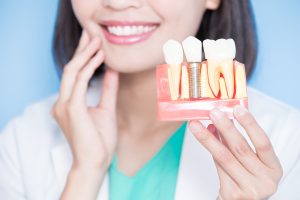 Dental Implants on Gold Coast