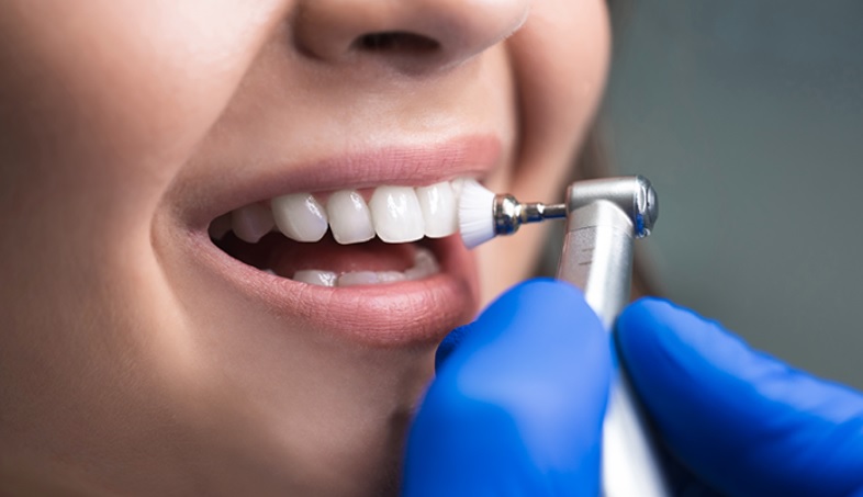 Teeth Cleaning Gold Coast