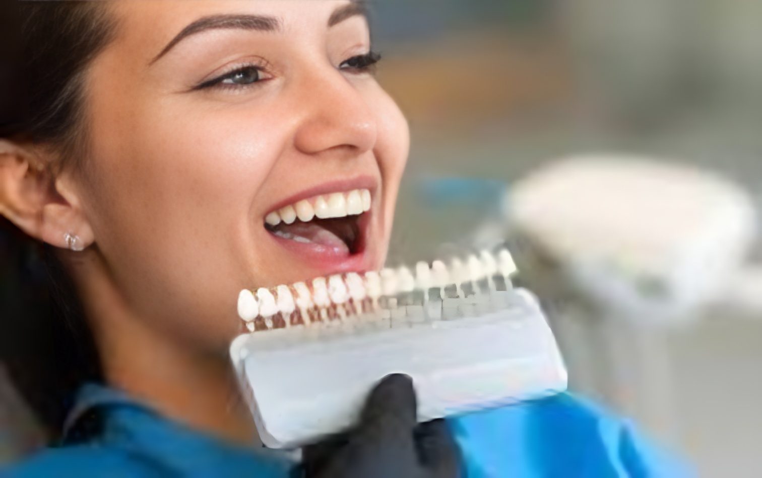 How long do porcelain veneers last​