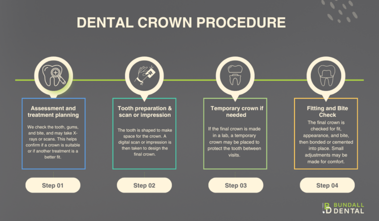 Dental Crown Procedure
