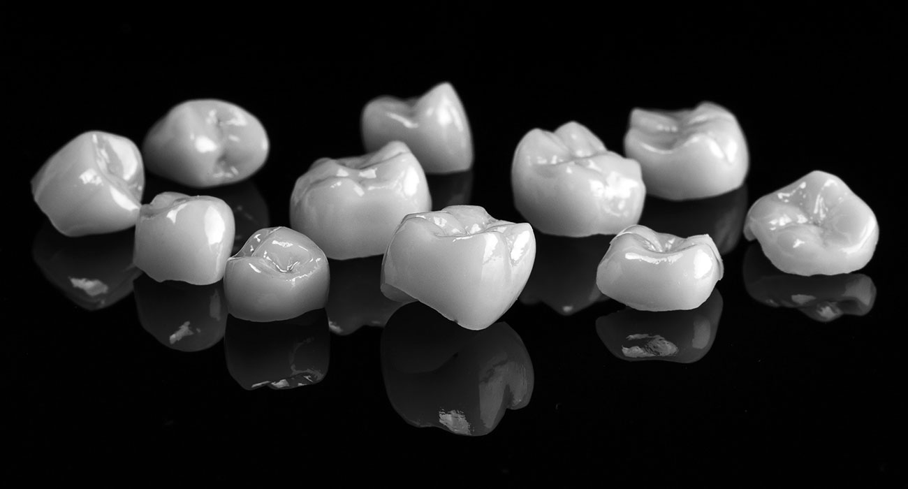 Restorative Dentistry Gold Cost, Bundall Dentall