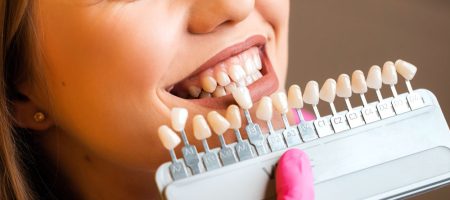 Dental Bonding in Gold Coast