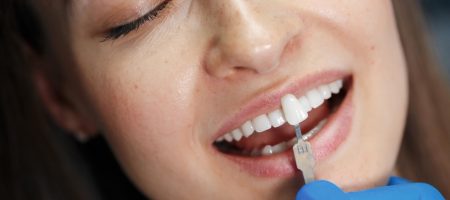 Dentist matches tooth shade with a veneer sample for cosmetic bonding.